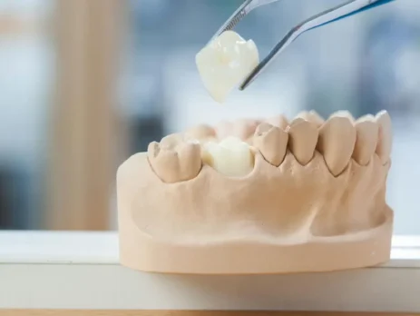 Dental professional positioning a ceramic crown on a dental model